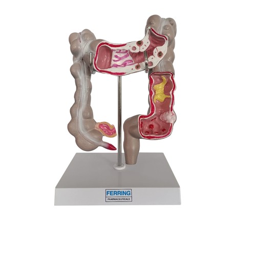 LARGE INTESTINE MODEL